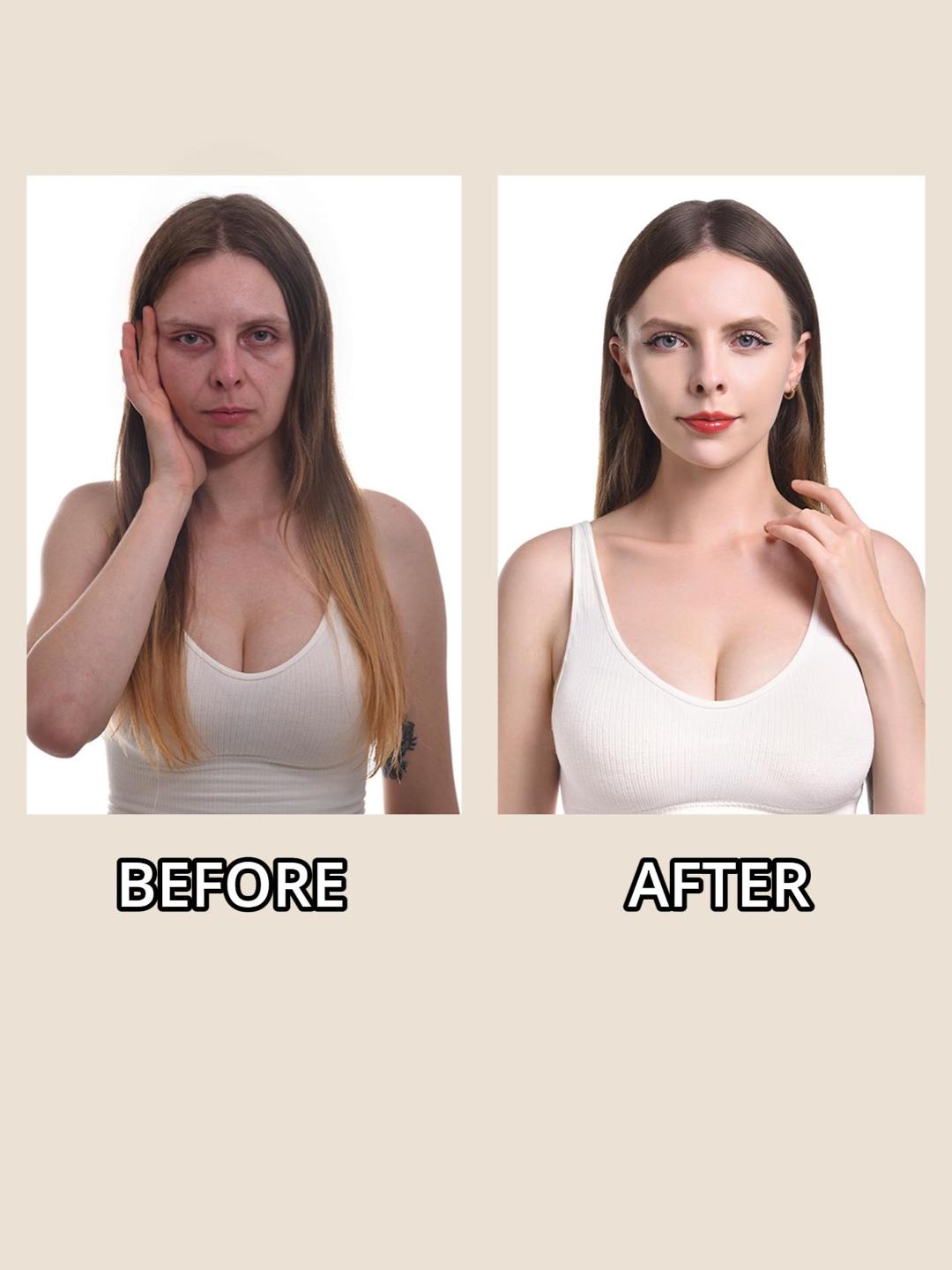 Facial rejuvenation before and after comparison